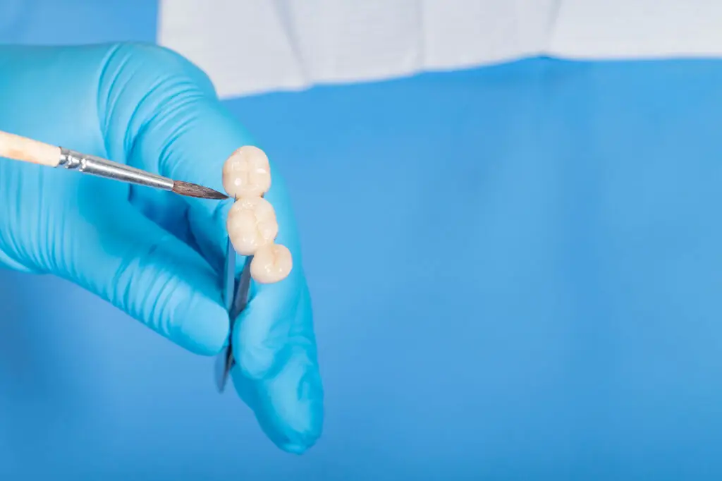 Dental Bridges In Lansdale: A Fixed Solution For Replacing Missing Teeth