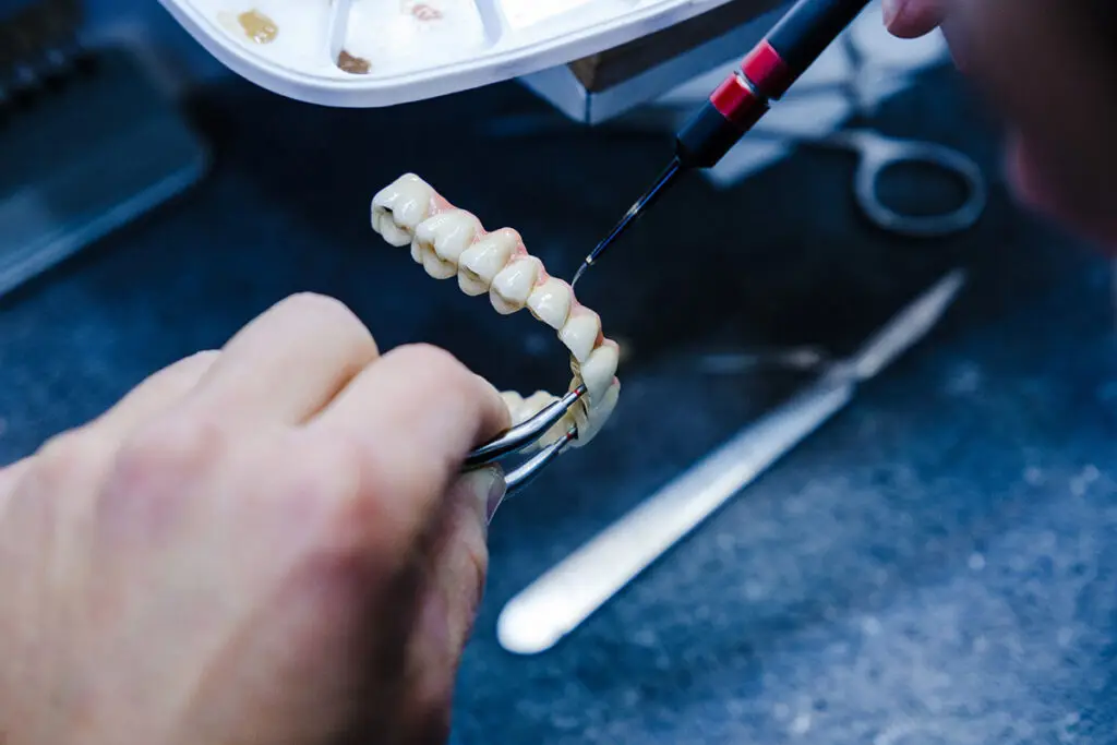 Implant-Supported Dentures In Lansdale: A More Secure Approach To Full-Arch Tooth Replacement