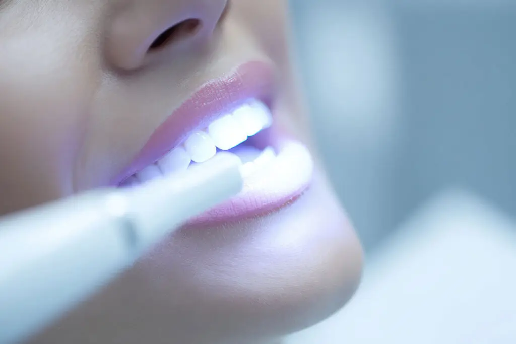 Professional Teeth Whitening In Lansdale: What Makes Dental Whitening Different